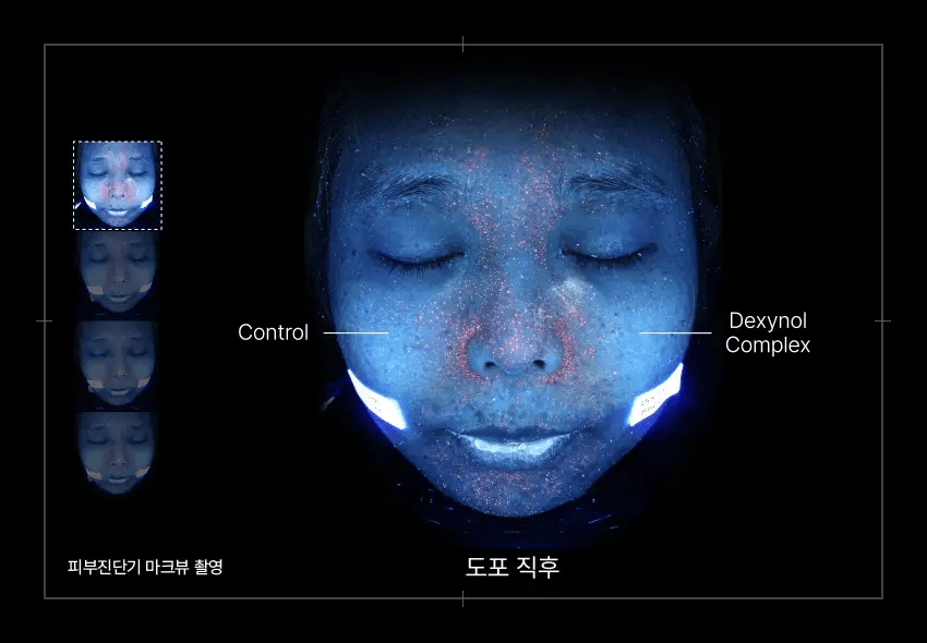 Dexynol-16.3 Acne-Line Trio Set